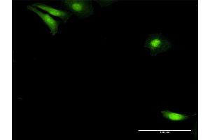 Immunofluorescence of purified MaxPab antibody to NUDC on HeLa cell. (NUDC anticorps  (AA 1-331))