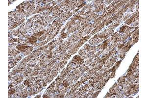 IHC-P Image NDUFV2 antibody detects NDUFV2 protein at mitochondria on mouse heart by immunohistochemical analysis. (NDUFV2 anticorps  (Center))