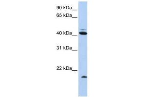 Ubiquitin D antibody used at 1 ug/ml to detect target protein. (UBD anticorps  (N-Term))