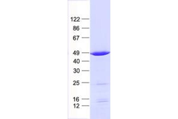 GABPB1 Protein (His tag)