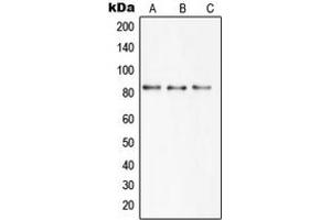 Western blot analysis of SBAT1 expression in HEK293T (A), mouse brain (B), rat brain (C) whole cell lysates. (SLC6A15 anticorps  (N-Term))