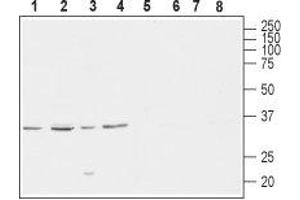 Western blot analysis of rat brain (lanes 1 and 5), mouse brain (lanes 2 and 6), human SH-SY5Y brain neuroblastoma (lanes 3 and 7) and  rat PC12 pheochromocytoma adrenal gland (lanes 4 and 8) lysates: - 1-4. (CACNG4 anticorps  (C-Term, Intracellular))