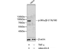 Western blot analysis of extracts of HeLa cells using Phospho-IKKα/β(S176/180) Polyclonal Antibody. (IKK-alpha /IKK-beta anticorps  (pSer176, pSer180))