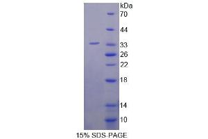 SDS-PAGE analysis of Human XYLT2 Protein. (XYLT2 Protéine)