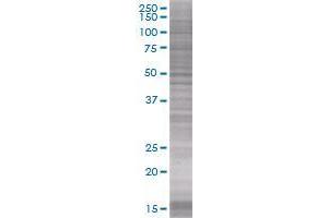 SH2D1B transfected lysate (SH2D1B 293T Cell Transient Overexpression Lysate(Denatured))