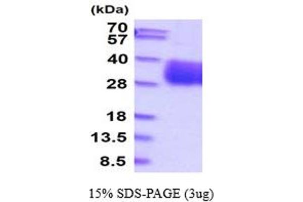 Retinoic Acid Early Transcript 1E (RAET1E) (AA 29-227) protein (His tag)