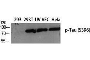 Western Blot (WB) analysis of specific cells using Phospho-Tau (S396) Polyclonal Antibody. (tau anticorps  (pSer396))