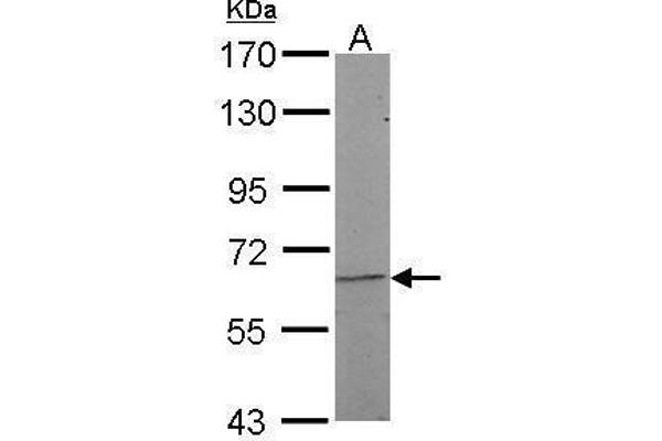 NR5A2 + LRH1 anticorps