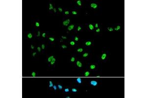 Immunofluorescence analysis of A549 cells using PAX2 Polyclonal Antibody (PAX2A anticorps)