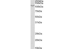 ABIN4902572 (1µg/ml) staining of U937 lysate (35µg protein in RIPA buffer). (CD68 anticorps)
