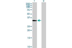 Western Blot analysis of ITPK1 expression in transfected 293T cell line by ITPK1 MaxPab polyclonal antibody. (ITPK1 anticorps  (AA 1-314))