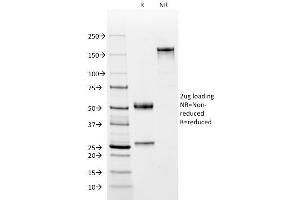 SDS-PAGE Analysis Purified CD2 Mouse Monoclonal Antibody (BH1). (CD2 anticorps)