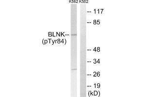 Western Blotting (WB) image for anti-B-Cell Linker (BLNK) (pTyr84) antibody (ABIN1847670) (B-Cell Linker anticorps  (pTyr84))