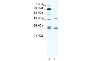 Western Blot showing ZNF488 antibody used at a concentration of 1-2 ug/ml to detect its target protein. (ZNF488 anticorps  (C-Term))