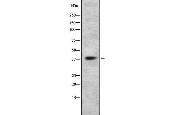 P2RY14 anticorps  (Internal Region)