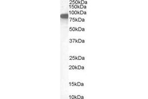 ABIN2562512 (1µg/ml) staining of Human Placenta lysate (35µg protein in RIPA buffer). (Ezrin anticorps  (Internal Region))