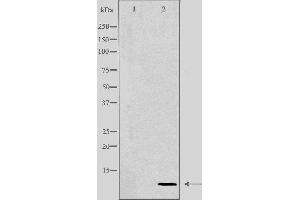 Western blot analysis of extracts from HeLa cells using COX17 antibody. (COX17 anticorps  (N-Term))