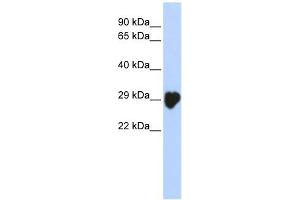 Carbonic Anhydrase I antibody used at 1 ug/ml to detect target protein. (CA1 anticorps  (N-Term))