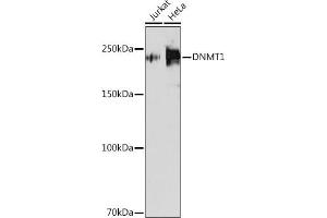 Western blot analysis of extracts of various cell lines, using DNMT1 antibody (ABIN7266808) at 1:1000 dilution. (DNMT1 anticorps)
