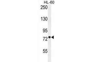 Western Blotting (WB) image for anti-Carnitine Palmitoyltransferase 1C (CPT1C) antibody (ABIN2996207) (CPT1C anticorps)