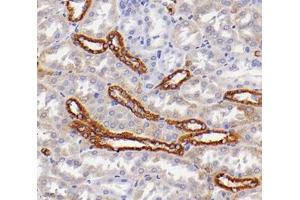 Immunohistochemistry analysis of paraffin-embedded mouse kidney using,ACOT9 (ABIN7072937) at dilution of 1: 4000 (ACOT9 anticorps)