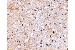 Immunohistochemistry (IHC) image for anti-Glutamate Receptor, Ionotropic, Kainate 1 (GRIK1) (C-Term) antibody (ABIN1030421) (GRIK1 anticorps  (C-Term))