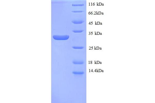 MT1E Protein (AA 4-59, partial) (GST tag)