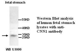 Image no. 1 for anti-Calponin antibody (ABIN790877) (Calponin anticorps)