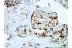 Immunohistochemistry analysis using Mouse Anti-Hsp60 Monoclonal Antibody, Clone LK-1 . (HSPD1 anticorps  (APC))