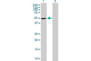 Western Blot analysis of ZNF383 expression in transfected 293T cell line by ZNF383 MaxPab polyclonal antibody. (ZNF383 anticorps  (AA 1-475))