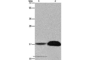 Western blot analysis of Mouse kidney and human kidney tissue, using FHIT Polyclonal Antibody at dilution of 1:600 (FHIT anticorps)