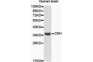 Western Blotting (WB) image for anti-Corticotropin Releasing Hormone (CRH) antibody (ABIN1872000) (CRH anticorps)