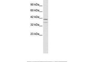 Image no. 1 for anti-CCAAT/enhancer Binding Protein (C/EBP), beta (CEBPB) (AA 239-288) antibody (ABIN6735936) (CEBPB anticorps  (AA 239-288))