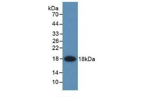 Detection of Recombinant FABP2, Rat using Monoclonal Antibody to Fatty Acid Binding Protein 2, Intestinal (FABP2) (FABP2 anticorps  (AA 2-132))