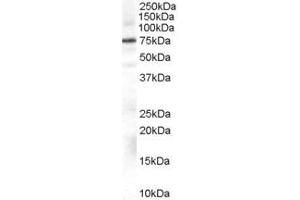 Western Blotting (WB) image for anti-Adrenergic, Beta, Receptor Kinase 1 (ADRBK1) (AA 319-331) antibody (ABIN296681) (GRK2 anticorps  (AA 319-331))
