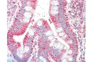 Anti-CSNK1A1 / CK1 Alpha antibody IHC staining of human small intestine. (CSNK1A1 anticorps)