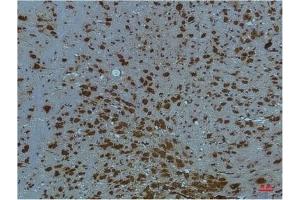 Immunohistochemical analysis of paraffin-embedded Mouse BrainTissue using PI3 Kinase P85 α Mouse mAb diluted at 1:200. (PIK3R1 anticorps)