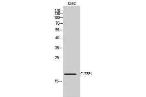 Western Blotting (WB) image for anti-Glucuronidase, beta Pseudogene 1 (GUSBP1) (Internal Region) antibody (ABIN6283061) (GUSBP1 anticorps  (Internal Region))