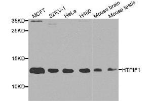 Western blot analysis of extracts of various cell lines, using ATPIF1 antibody. (ATPase Inhibitory Factor 1 anticorps  (AA 26-106))