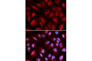 Immunofluorescence analysis of U2OS cells using MCM5 antibody. (MCM5 anticorps)