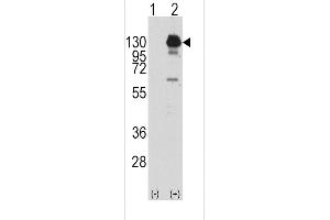 Western blot analysis of PDGFRA using rabbit polyclonal PDGFRA Antibody (Y762) using 293 cell lysates (2 ug/lane) either nontransfected (Lane 1) or transiently transfected with the PDGFRA gene (Lane 2). (PDGFRA anticorps  (AA 740-769))