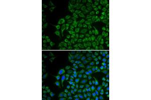 Immunofluorescence analysis of U2OS cells using TYR antibody (ABIN5970593). (TYR anticorps)