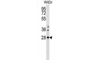 Western Blotting (WB) image for anti-THAP Domain Containing 10 (THAP10) antibody (ABIN3000131) (THAP10 anticorps)