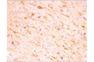 IHC-P testing of mouse brain tissue (SIRT2 anticorps  (AA 165-187))