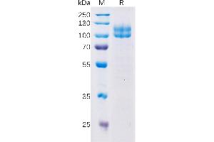 Human SL Protein, hFc Tag on SDS-PAGE under reducing condition. (LY9 Protein (AA 48-454) (Fc Tag))