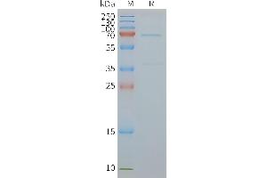 Human EN-Nanodisc, Flag Tag on SDS-PAGE (ENTPD2 Protéine)