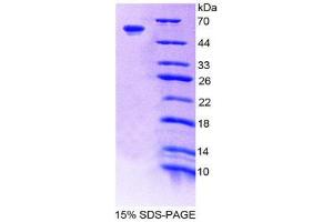 SDS-PAGE (SDS) image for Coagulation Factor XI (F11) (AA 275-516) protein (His tag,GST tag) (ABIN2122662) (Factor XI Protein (AA 275-516) (His tag,GST tag))