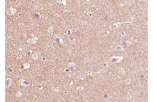 ABIN6268670 at 1/100 staining human brain tissue sections by IHC-P. (Angiopoietin 2 anticorps  (N-Term))