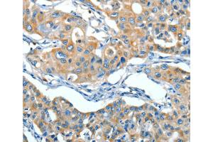 Immunohistochemistry (IHC) image for anti-serpin Peptidase Inhibitor, Clade A (Alpha-1 Antiproteinase, Antitrypsin), Member 3 (SERPINA3) antibody (ABIN2422541) (SERPINA3 anticorps)