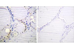 P-peptide - + (Aconitase 1 anticorps  (pSer711))